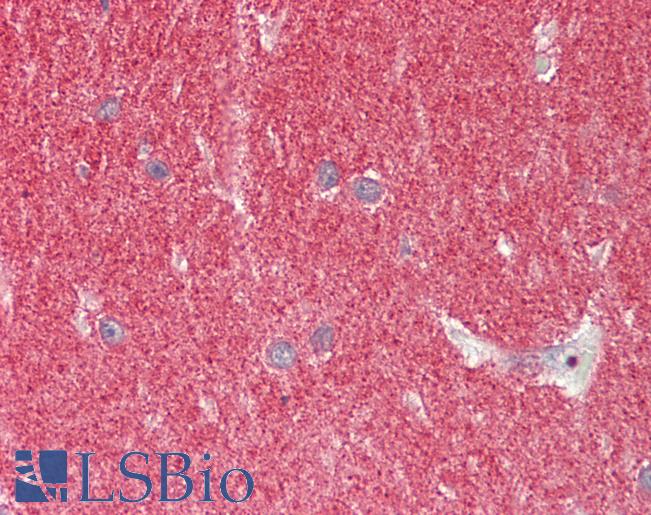Anti-SNCA / Alpha-Synuclein antibody IHC staining of human brain, cerebellum. Immunohistochemistry of formalin-fixed, paraffin-embedded tissue after heat-induced antigen retrieval. Antibody LS-B11186 concentration 5 ug/ml.