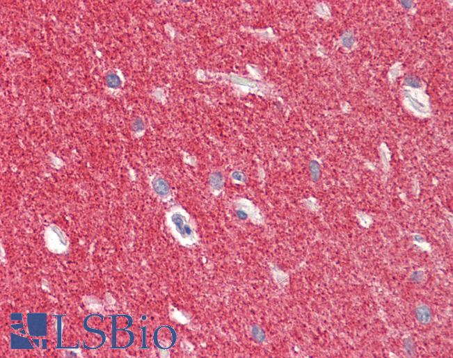Anti-SNCA / Alpha-Synuclein antibody IHC staining of human brain, cerebellum. Immunohistochemistry of formalin-fixed, paraffin-embedded tissue after heat-induced antigen retrieval. Antibody LS-B11185 concentration 5 ug/ml.