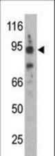 The anti-Synphilin-1 C-term antibody is used in Western blot to detect Synphilin-1 in mouse brain lysate.