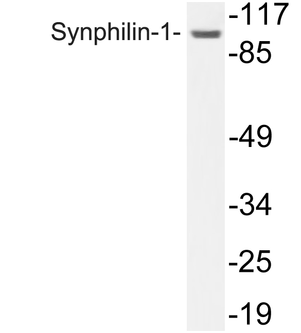 Western blot of Synphilin-1 (R846) pAb in extracts from COLO205.