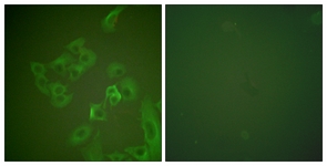 Immunofluorescence of A549 cells, using Synuclein beta Antibody. The picture on the right is treated with the synthesized peptide.