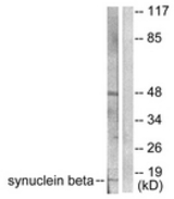 Western blot of extracts from HeLa cells, using Synuclein beta Antibody. The lane on the right is treated with the synthesized peptide.