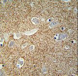 SNCB antibody immunohistochemistry of formalin-fixed and paraffin-embedded human brain tissue followed by peroxidase-conjugated secondary antibody and DAB staining.