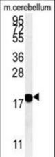 SNCB Antibody western blot of mouse cerebellum tissue lysates (15 ug/lane). The SNCB antibody detected SNCB protein (arrow).