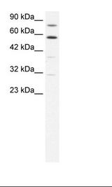Raji Cell Lysate