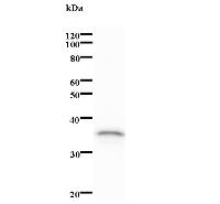 Western blot analysis of immunized recombinant protein, using anti-EBNA2 monoclonal antibody.