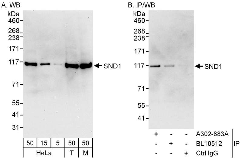 Detection of Human and Mouse SND1 by Western Blot (h&m) and Immunoprecipitation (h). Samples: Whole cell lysate from HeLa (5, 15 and 50 ug for WB; 1 mg for IP, 20% of IP loaded), 293T (T; 50 ug), and mouse NIH3T3 (M; 50 ug) cells. Antibodies: Affinity purified rabbit anti-SND1 antibody used for WB at 0.04 ug/ml (A) and 0.4 ug/ml (B) and used for IP at 3 ug/mg lysate. SND1 was also immunoprecipitated by rabbit anti-SND1 antibody BL10512, which recognizes a downstream epitope. Detection: Chemiluminescence with exposure times of 30 seconds (A) and 10 seconds (B).