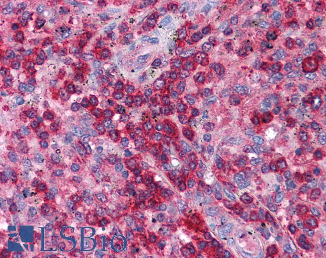 Anti-SNF8 / EAP30 antibody IHC of human spleen. Immunohistochemistry of formalin-fixed, paraffin-embedded tissue after heat-induced antigen retrieval. Antibody LS-B4561 concentration 5 ug/ml.