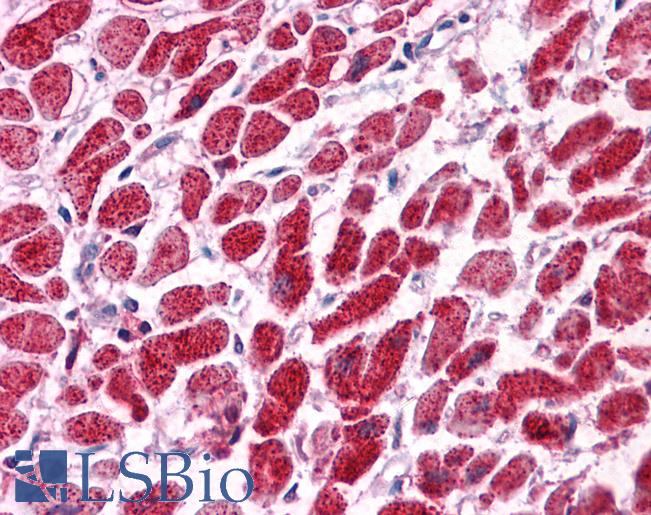 Anti-SNF8 / EAP30 antibody IHC of human heart. Immunohistochemistry of formalin-fixed, paraffin-embedded tissue after heat-induced antigen retrieval. Antibody LS-B4561 concentration 5 ug/ml.