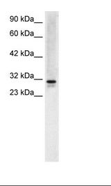 HepG2 Cell Lysate.