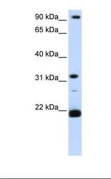 Hela cell lysate. Antibody concentration: 1.0 ug/ml. Gel concentration: 12%.