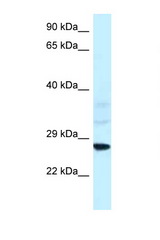 SNF8 / EAP30 antibody LS-C145435 Western blot of Rat Liver lysate. Antibody concentration 1 ug/ml.