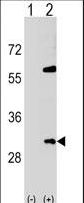 Western blot of SNF8 (arrow) using rabbit polyclonal SNF8 Antibody. 293 cell lysates (2 ug/lane) either nontransfected (Lane 1) or transiently transfected (Lane 2) with the SNF8 gene.