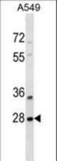 SNF8 Antibody western blot of A549 cell line lysates (35 ug/lane). The SNF8 antibody detected the SNF8 protein (arrow).