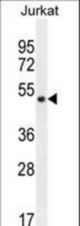 SNIP1 Antibody western blot of Jurkat cell line lysates (35 ug/lane). The SNIP1 antibody detected the SNIP1 protein (arrow).