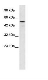 Jurkat Cell Lysate