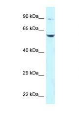 PLK2 antibody LS-C145774 Western blot of Jurkat Cell lysate. Antibody concentration 1 ug/ml.