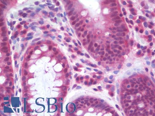 Anti-SNK / PLK2 antibody IHC staining of human colon. Immunohistochemistry of formalin-fixed, paraffin-embedded tissue after heat-induced antigen retrieval. Antibody LS-B9872 concentration 10 ug/ml.