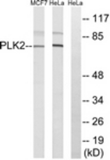 Western blot of extracts from HeLa/MCF-7 cells, using PLK2 Antibody. The lane on the right is treated with the synthesized peptide.