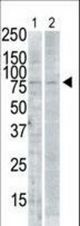 The anti-SNK C-term antibody is used in Western blot to detect SNK in PMA-treated Pam212 cell lysate (lane 1) and rat testis tissue lysate (lane 2).