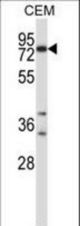 Mouse Plk2 Antibody western blot of CEM cell line lysates (35 ug/lane). The Plk2 antibody detected the Plk2 protein (arrow).