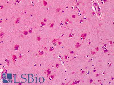 Anti-SNPH antibody IHC of human brain, cortex. Immunohistochemistry of formalin-fixed, paraffin-embedded tissue after heat-induced antigen retrieval. Antibody LS-B4980 concentration 5 ug/ml.