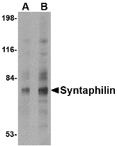 Western blot of Syntaphilin in human brain tissue lysate with Syntaphilin antibody at (A) 2 and (B) 4 ug/ml.