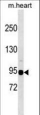 Mouse Snrk Antibody western blot of mouse heart tissue lysates (35 ug/lane). The Snrk antibody detected the Snrk protein (arrow).