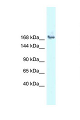 SNRNP200 antibody LS-C145856 Western blot of COL0205 Cell lysate. Antibody concentration 1 ug/ml.