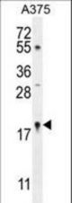 SNR27 Antibody western blot of A375 cell line lysates (35 ug/lane). The SNR27 antibody detected the SNR27 protein (arrow).