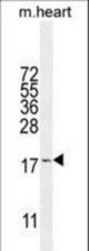 SNR27 Antibody western blot of mouse heart tissue lysates (35 ug/lane). The SNR27 antibody detected the SNR27 protein (arrow).