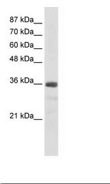 Jurkat Cell Lysate
