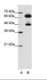 B: HepG2 Cell Lysate