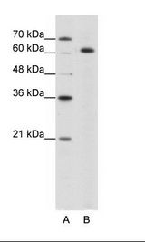 A: Marker, B: HepG2 Cell Lysate
