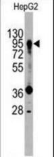 Western blot of anti-PROX1 Antibody in HepG2 cell line lysates (35 ug/lane). PROX1(arrow) was detected using the purified antibody.