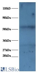 Western blot of U1 small nuclear ribonucleoprotein A polyclonal Antibody at 2 ug/ml + EC109 whole cell lysate at 20 ug. Secondary: Goat polyclonal to Rabbit IgG at 1:15000 dilution. Predicted band size: 31 kDa. Observed band size: 31 kDa Additional bands at: 52 kDa. We are unsure as to the identity of this extra band.