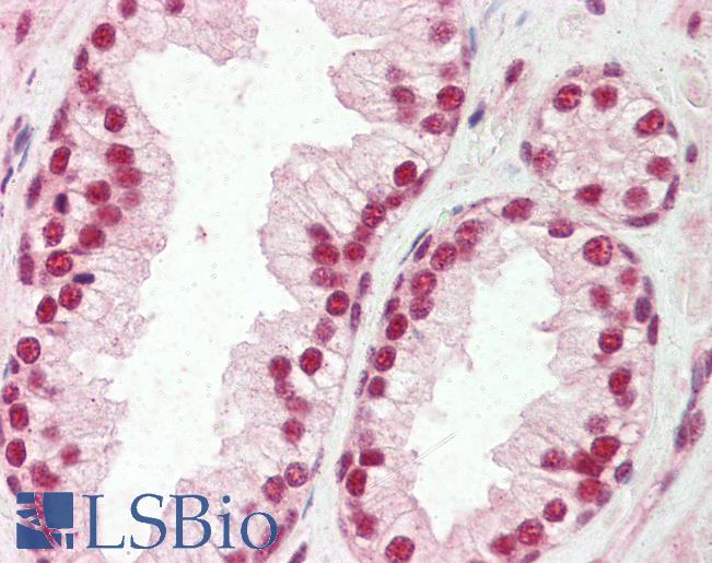 Anti-SNRPA antibody IHC of human prostate. Immunohistochemistry of formalin-fixed, paraffin-embedded tissue after heat-induced antigen retrieval. Antibody LS-B3541 concentration 5 ug/ml.