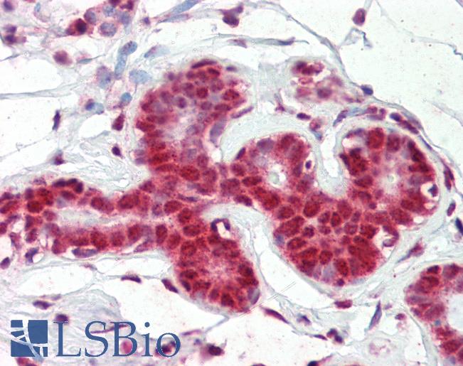 Anti-SNRPA antibody IHC of human breast. Immunohistochemistry of formalin-fixed, paraffin-embedded tissue after heat-induced antigen retrieval. Antibody LS-B3541 concentration 5 ug/ml.