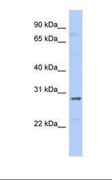 Fetal liver lysate. Antibody concentration: 1.0 ug/ml. Gel concentration: 12%.