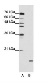 A: Marker, B: Jurkat Cell Lysate