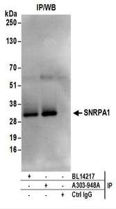 Detection of Human SNRPA1 by Western Blot of Immunoprecipitates. Samples: Whole cell lysate (1 mg for IP; 20% of IP loaded) from Jurkat cells. Antibodies: Affinity purified rabbit anti-SNRPA1 antibody used for IP at 6 ug/mg lysate. SNRPA1 was also immunoprecipitated by rabbit anti-SNRPA1 antibody BL14217. For blotting immunoprecipitated SNRPA1, was used at 1 ug/ml. Detection: Chemiluminescence with an exposure time of 10 seconds.