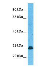 Western blot of RSMB Antibody with human Fetal Lung lysate.