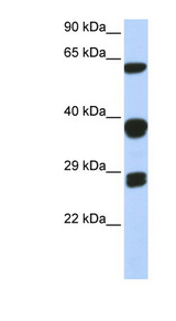 SNRPB antibody LS-C101844 Western blot of 293T cell lysate.