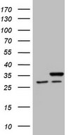 HEK293T cells were transfected with the pCMV6-ENTRY control (Left lane) or pCMV6-ENTRY SNRPB2 (Right lane) cDNA for 48 hrs and lysed. Equivalent amounts of cell lysates (5 ug per lane) were separated by SDS-PAGE and immunoblotted with anti-SNRPB2 (1:2000).