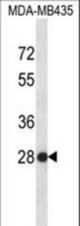 SNRPB2 Antibody western blot of MDA-MB435 cell line lysates (35 ug/lane). The SNRPB2 antibody detected the SNRPB2 protein (arrow).