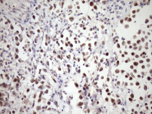 IHC of paraffin-embedded Human bladder tissue using anti-SNRPB2 mouse monoclonal antibody. (Heat-induced epitope retrieval by Tris-EDTA, pH8.0)(1:150).