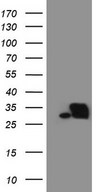 HEK293T cells were transfected with the pCMV6-ENTRY control (Left lane) or pCMV6-ENTRY SNRPB2 (Right lane) cDNA for 48 hrs and lysed. Equivalent amounts of cell lysates (5 ug per lane) were separated by SDS-PAGE and immunoblotted with anti-SNRPB2 (1:2000).