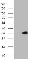 HEK293T cells were transfected with the pCMV6-ENTRY control (Left lane) or pCMV6-ENTRY SNRPB2 (Right lane) cDNA for 48 hrs and lysed. Equivalent amounts of cell lysates (5 ug per lane) were separated by SDS-PAGE and immunoblotted with anti-SNRPB2.
