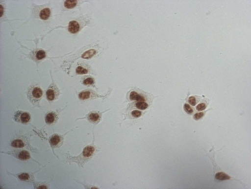 Immunocytochemistry staining of MCF-7 cells using anti-SNRPB2 mouse monoclonal antibody.(1:100).