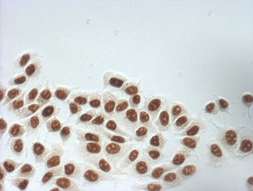 Immunocytochemistry staining of MCF-7 cells using anti-SNRPB2 mouse monoclonal antibody.(1:100).